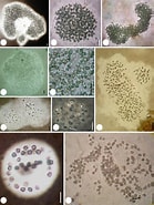 Afbeeldingsresultaten voor "Protocystis Bicuspid". Grootte: 139 x 185. Bron: www.researchgate.net