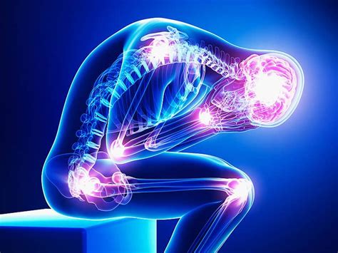 Chronic Nerve Pain From Shingles Or Diabetes Austrials Website