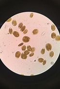Afbeeldingsresultaten voor "ostreopsis Labens". Grootte: 124 x 185. Bron: www.reef2reef.com