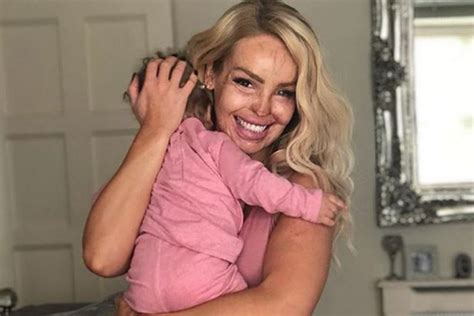 How Acid Attack Trauma Helped Katie Piper Strengthen Her Faith In God
