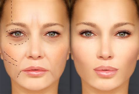 requested cosmetic plastic surgery procedures pmcaonline