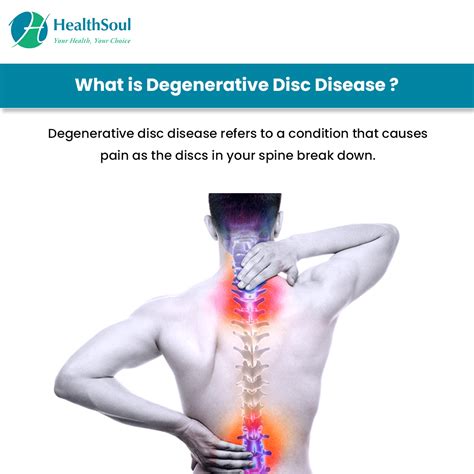 degenerative disc disease  symptoms  treatment healthsoul
