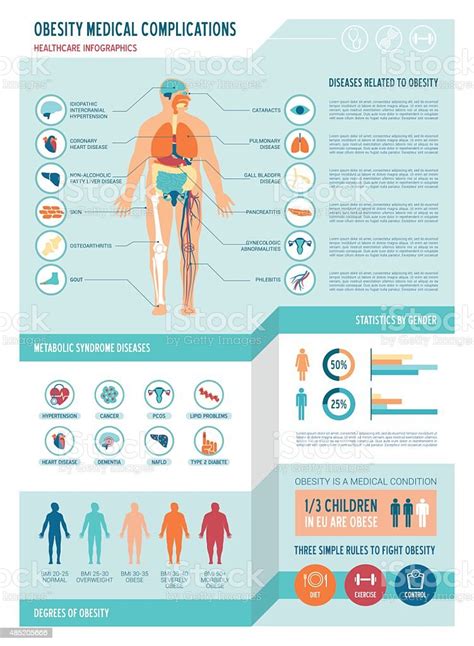 obesity infographics stock vector art 485205666 istock