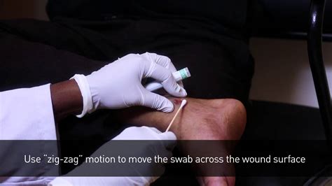 healthcare wound swab collection procedure youtube
