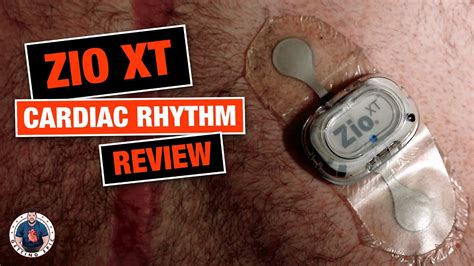 zio xt patch review cardiac rhythm monitor youtube