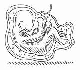Fetus Ramspott sketch template