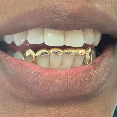 solid gold  bottom drips openface design london bridge gold