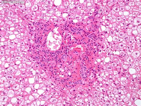 a collection of surgical pathology images pathology tutorial images