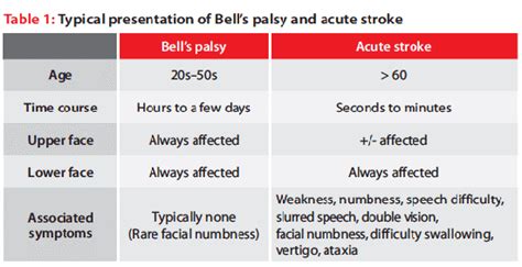 bell s palsy vs stroke how to distinguish them new