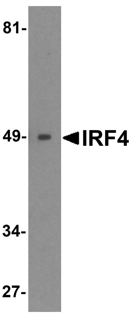 irf antibody pa