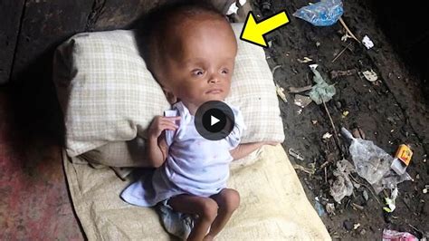This Girls Mother Abandoned Her When She Saw Her Head You Wont