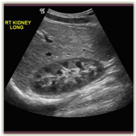 ultrasound prohealth advanced imaging