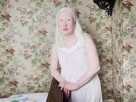 Albinos Nude Gay Porn Sharing