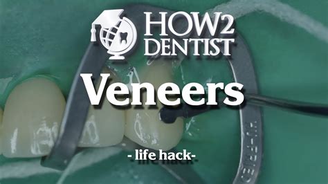 fix veneers   dentist youtube