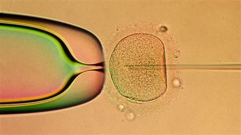 Fertility And Infertility Treatments What Your Doctor Won