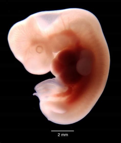 multi dimensional human embryo result page
