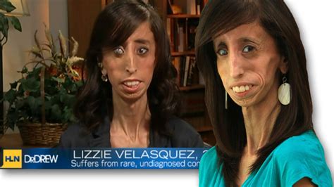 lizzie velasquez answers bullies who branded her the world s ugliest