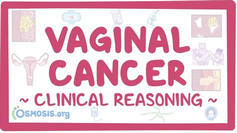 clinical reasoning vaginal cancer osmosis