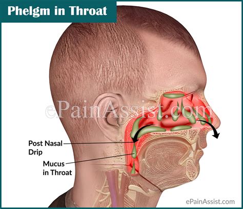 phlegm  throat  mucus  throat  ways   rid