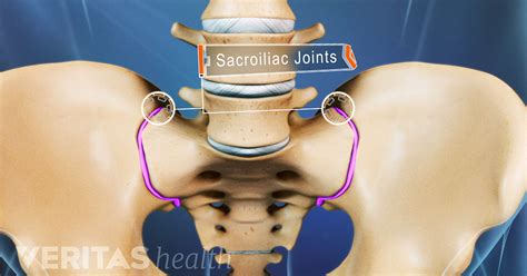 sacroiliac joint dysfunction  joint pain