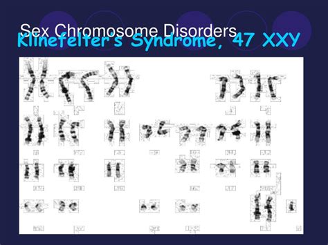 Ppt Pedigrees And Karyotypes Powerpoint Presentation Free Download