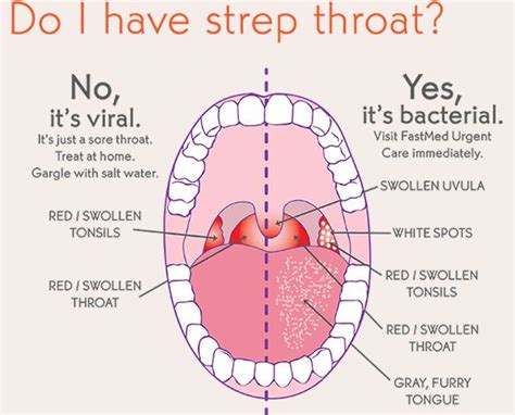wellness lab health info what is strep throat