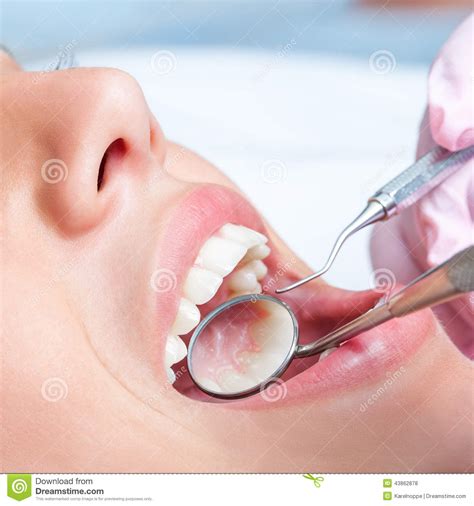 dental tools to keep mouth open