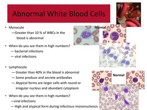 abnormal blood cell morphology powerpoint