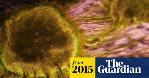 breast cancer spread ‘trigger discovered society the guardian