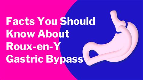 What You Need To Know Before Roux En Y Gastric Bypass Surgery