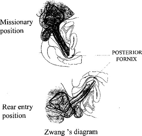 figure 2 from magnetic resonance imaging mri of sexual intercourse