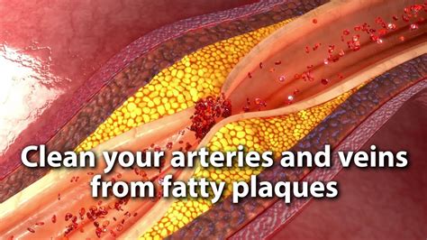 clean  arteries  veins  fatty plaques youtube