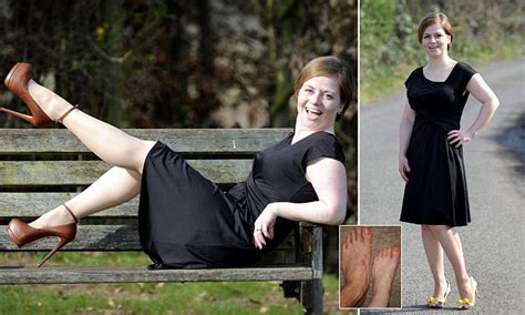 woman 36 with tiny size two feet who found it impossible to walk in