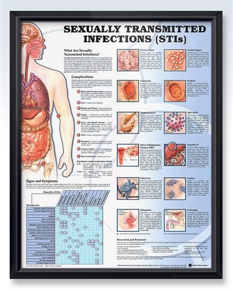 sexually transmitted infections chart 20x26 sexually transmitted