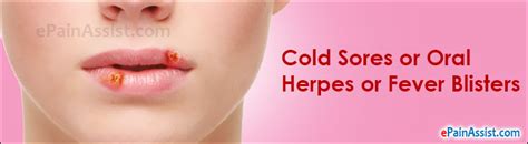cold sores or oral herpes causes symptoms treatment