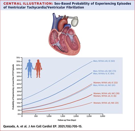 Sex Specific Ventricular Arrhythmias And Mortality In Cardiac