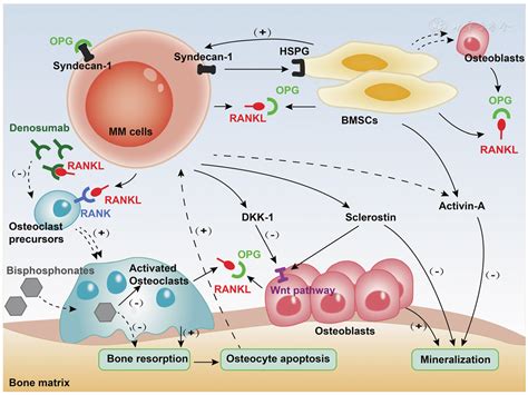 pathophysiology  therapeutic advances  myeloma bone disease chronic diseases