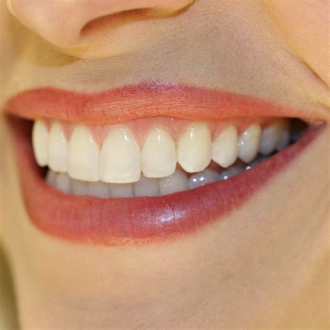 bellevue dentists advise resolving tooth  gum issues brookside dental