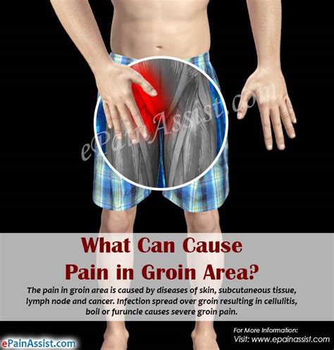 What Can Cause Pain In Groin Area