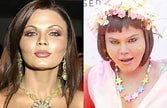 Image result for Rakhi Sawant Before and After Surgery. Size: 167 x 108. Source: plasticsurgerystar.org