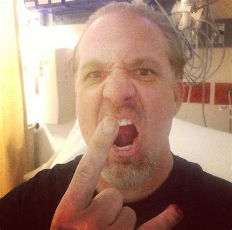 Jesse James Chops Pinky Off In Shop Accident Shares Photos On