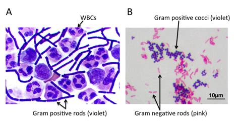 Bacteria 101 Cell Walls Gram Staining Common Pathogens