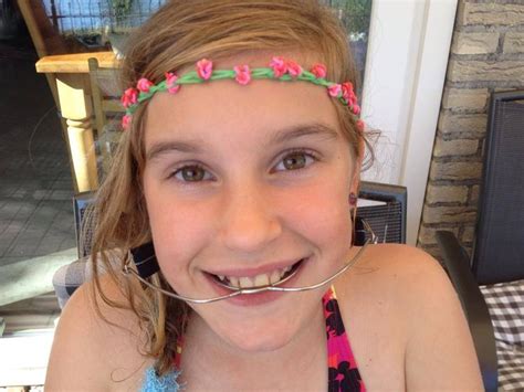 pin by larry greenstein on girls with dental braces and headgear in