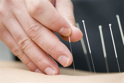 acupuncture offer pain relief  reduce opioid  vermont funds