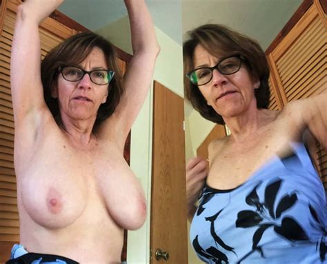 before after granny 241 pics 3 xhamster