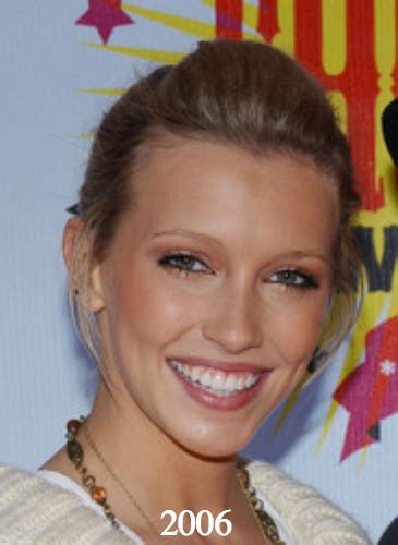 katie cassidy plastic surgery before and after photos