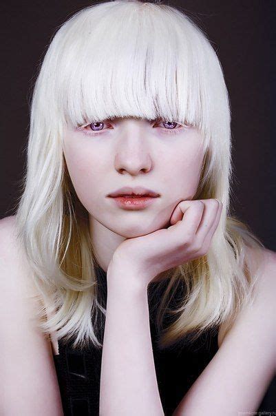 nastya zhidkova nastya zhidkova albinism albino model unique faces