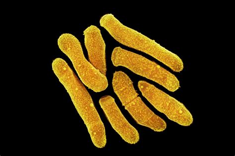 5 tipos de bactérias que vivem em sua pele