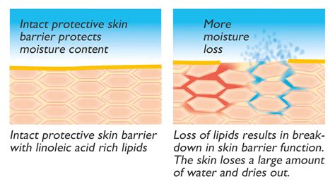 dry skin linola guide