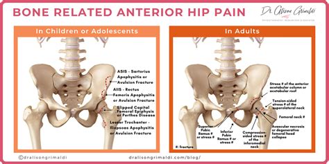 differential diagnosis  anterior hip pain bone dr alison grimaldi